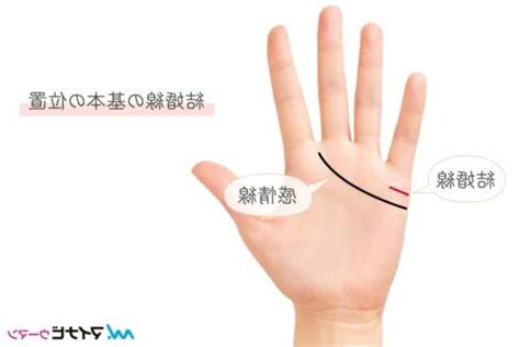 離婚線 右手